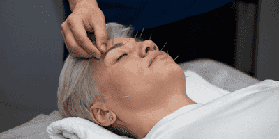 Acupuncture Training Course